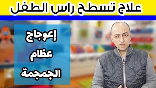 علاج تسطح راس الطفل و اعوجاج عظام الجمجمة عند الاطفال - دكتور حاتم فاروق
