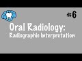 Oral Radiology | Radiographic Interpretation | NBDE Part II