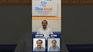 Life-Changing Smile With Basal Implants Patient Testimonial - Get Fixed Teeth Within 72Hrs