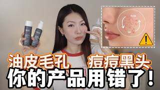 【夏季护肤特辑】油皮别乱刷酸！我的护肤流程保养步骤｜控油、黑头、毛孔、痘印怎么护理？Skin Care Routine for Oily Skin screenshot 5