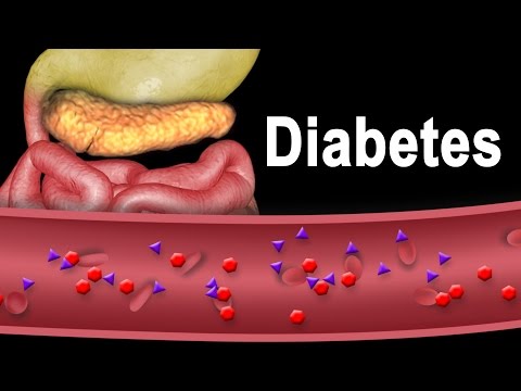 Diabetes