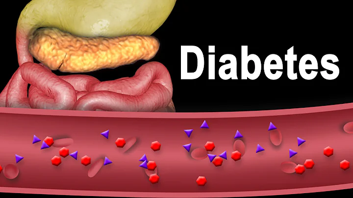 Diabetes Type 1 and Type 2, Animation. - DayDayNews