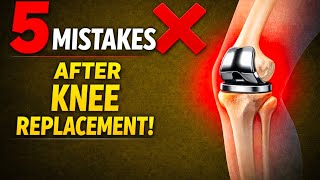 👉 “Knee Replacement Ke Baad Ye 5 Galtiyan Result Kharab Kar Deti Hain”