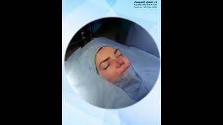 فيديو من داخل العمليات مع  دكتور حسام السيسي