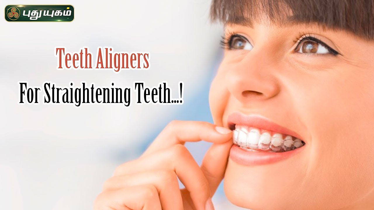 Teeth Aligners for Straightening Teeth...! | #Puthuyugamtv | 15/02/2024 ...
