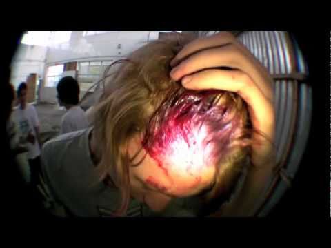 Skateboard to the face