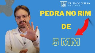 Pedra No Rim De 5Mm Pode Ou Não Sair Sozinha?