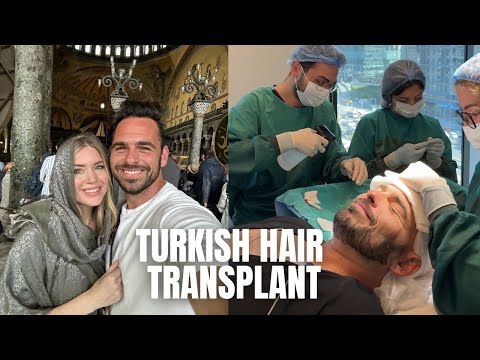 Hair Transplant In Turkey!! 😳 Istanbul + Cappadocia