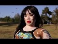 Vitiligo Queen Is Comfortable In Her Own Skin