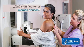 ¿Quién tiene más probabilidades de tener mamas densas?