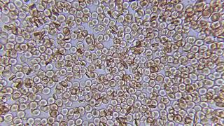 Røde Blodceller - Under Mikroskopet YouTube