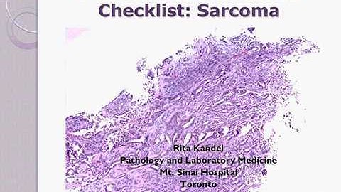 CAP education session Sarcoma in community and centralized settings Dr Kandel 2014