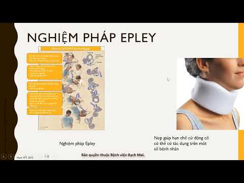 9- Rối loạn tiền đình: Dấu hiệu nhận biết và xử trí tại nhà