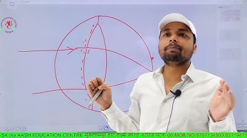 Eye defects. Near vision defects. Far vision defects. Just shown away. Eye 👀 Dosh.