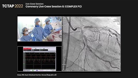 [TCAP 2022] Coronary Live Case Session 6: COMPLEX PCI