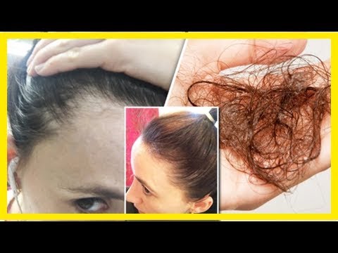 نصائح طبية لعلاج تساقط الشعر من عيادة دكتور أوز