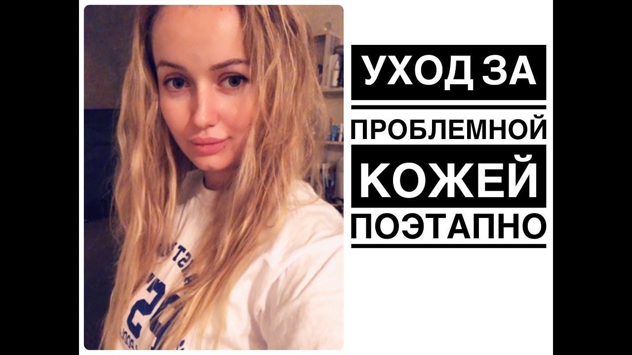 Последний День 5. Жирная Себорея, жирная кожа=прыщи