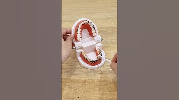 Chăm sóc răng niềng sạch sẽ từng kẽ răng với tăm nước Magic B-02 #review  #banchaidien #tips