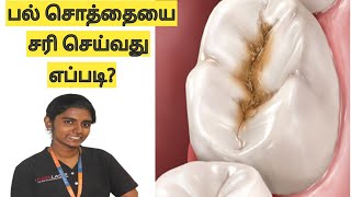 பல் சொத்தைக்கான காரணங்களும் தீர்வுகளும் (Reasons, treatment for tooth cavity in Tamil)