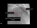 Coronary artery anatomy  coronary angiogram