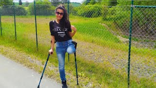 Frau stumpf amputierte JASMIN Frau stumpf amputierte In der