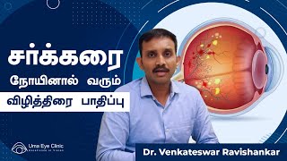 Diabetic Retinopathy & It’s Treatment | சக்கரை நோயினால் வரும் விழித்திரை பாதிப்பு | Dr Venkatesh