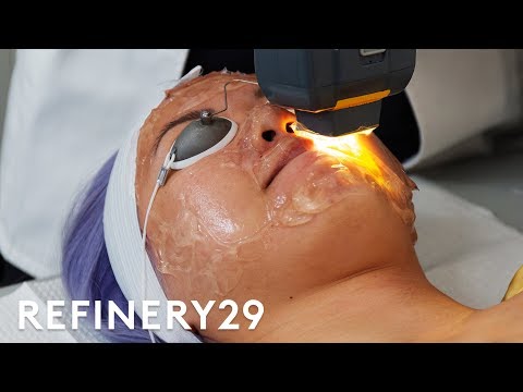 I Got The $ Laser Facial For Acne | Beauty With Mi | Refinery