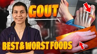 Best & Worst Foods to Eat with Gout | The 1 Best Protocol for Gout