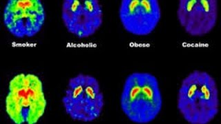 Edm Music Effects On Brain | Popnable