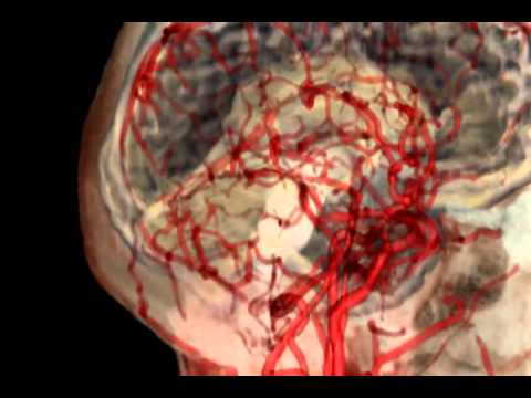 What are Thrombosis & Embolism?