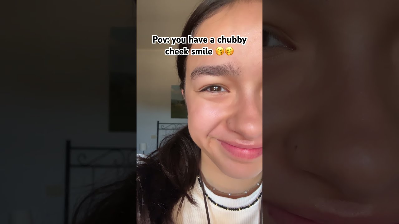 Do YOU Have Chubby Cheeks Fyp Shorts Relatable Trend Skit Justjules Travel Viral