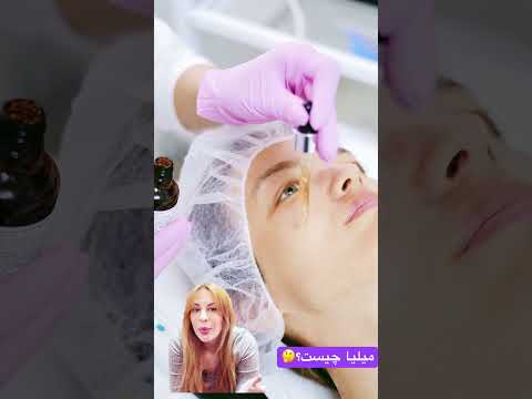 میلیا چیست و راه های درمان آن کدام است میلیا لیزر رتینول