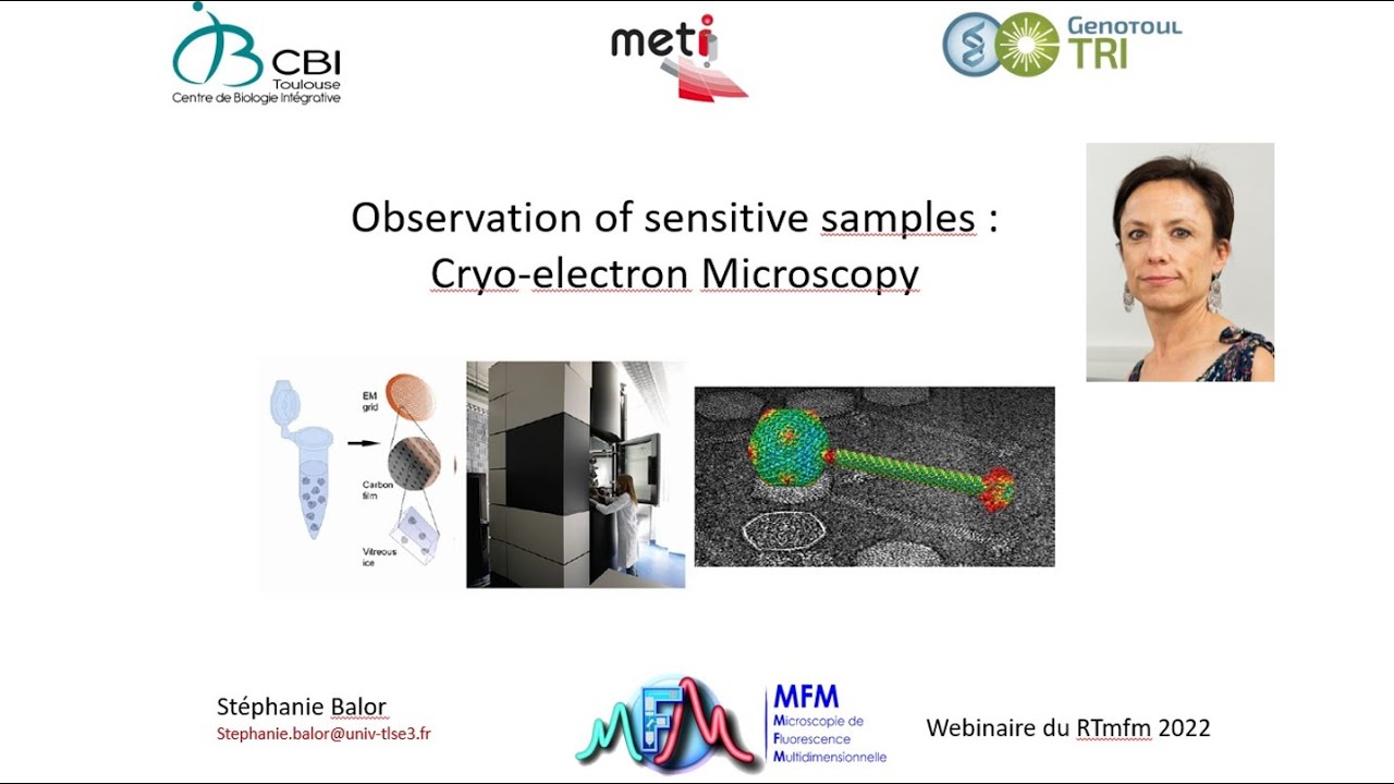 Observation of sensitive samples : Cryo-electron Microscopy