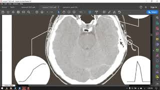 Famous Digital Image Processing - Lecture 7 Wealth