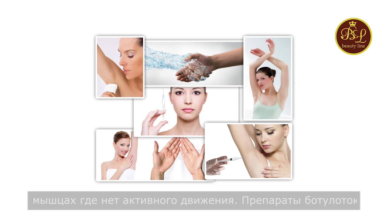 Ботокс-правда и мифы. Лечение гипергидроза