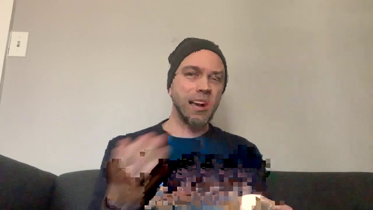 Subcutaneous Ulnar Nerve Transposition 1 Day Post Op YouTube subcutaneous-ulnar-nerve-transposition-1-day-post-op-youtube