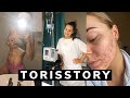 My story  torisstory