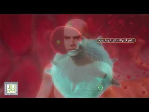 أنيميا تحطم خلايا الدم الحمراء  