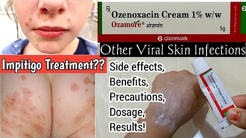 Ozamore/Ozamore Cream/Ozenoxacin Cream/Impetigo Cream uses, when to use, precautions etc.