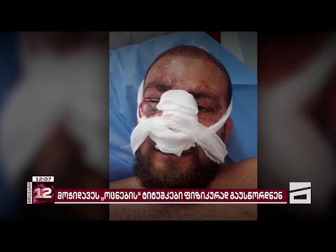 \"ოცნების\" ტიტუშკები თავს კიდევ ერთ მოქალაქეს დაესხნენ და სცემეს