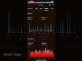 Upcoming Garmin Venu 3/3S #review #tennis activity #shorts #excerpt #garminsmartwatch
