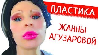 ЖАННУ АГУЗАРОВУ не узнать. Певица переборщила с пластикой, увеличив не только губы