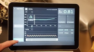 IntraSight is Seamless (2)