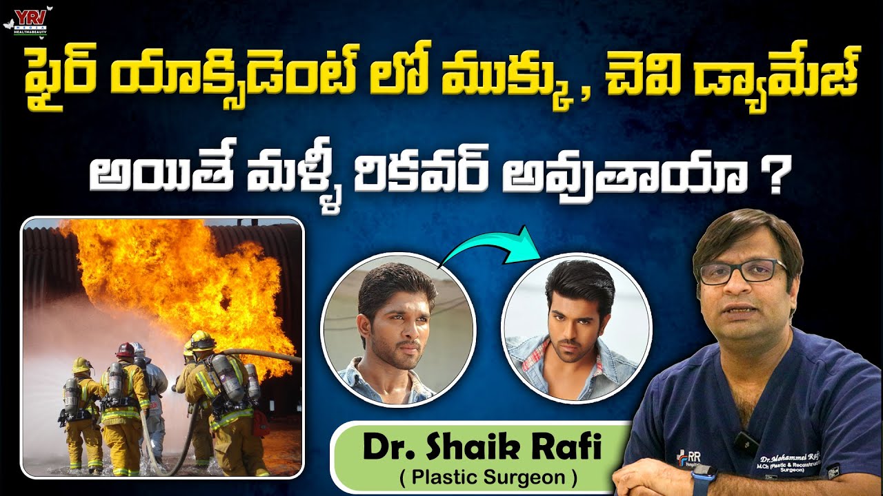Shaki Rafi ఫేస్ ట్రాన్స్ ప్లాంట్ నిజమేనా ? | Face Transplant | Telugu | Dr Shaik ...