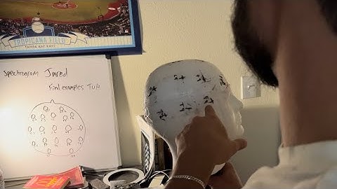 teaching my friend the 10-20 system EEG electrode sites