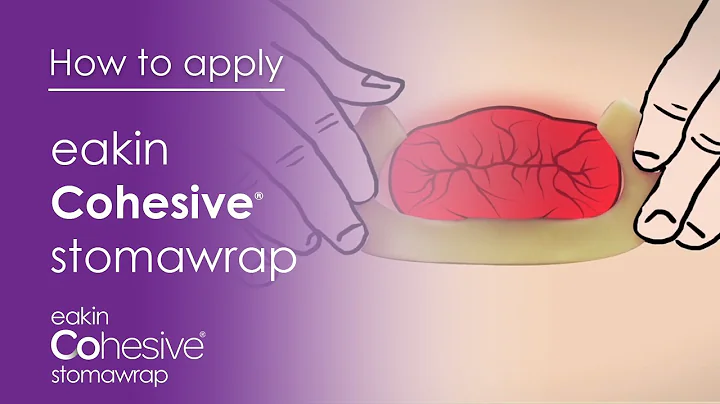 How to apply Cohesive StomaWrap