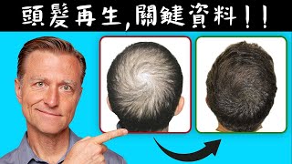 頭髮再生吃什麼關鍵資料更新,自然療法,柏格醫生 Dr Berg