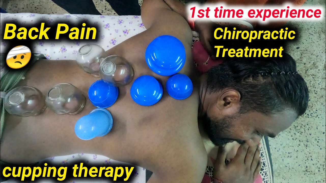 Back Pain Relief | Acupuncture, Chiropractic & Cupping Therapy