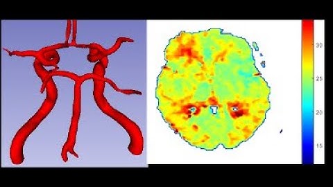 Biomedical Imaging and Devices