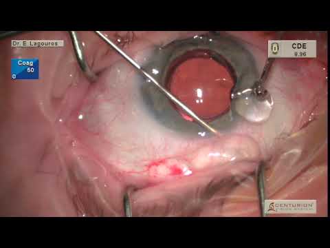 Semi Open Xen   SD 480p